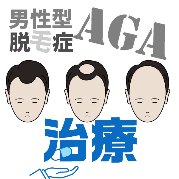 AGA(男性型脱毛症)治療