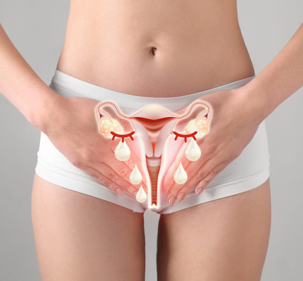 膣カンジダの症状と治療と対策の解説